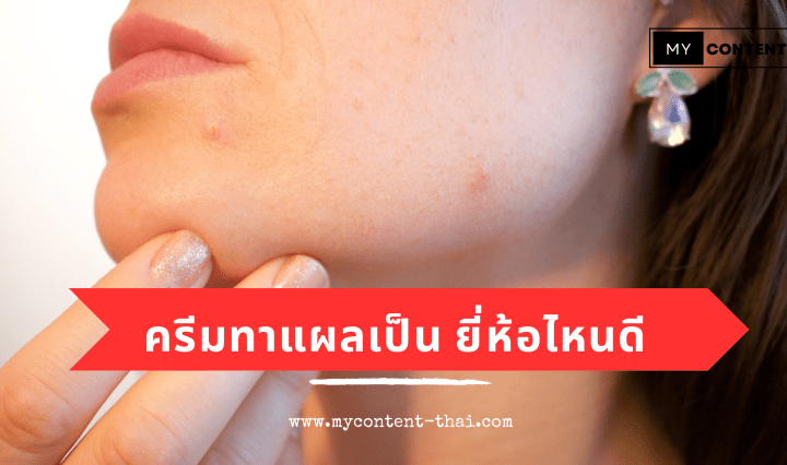 10 ยาทาแผลเป็น ครีมลดเลือนริ้วรอย ใบหน้า ผิวกาย แผลผ่าตัด หลังคลอด