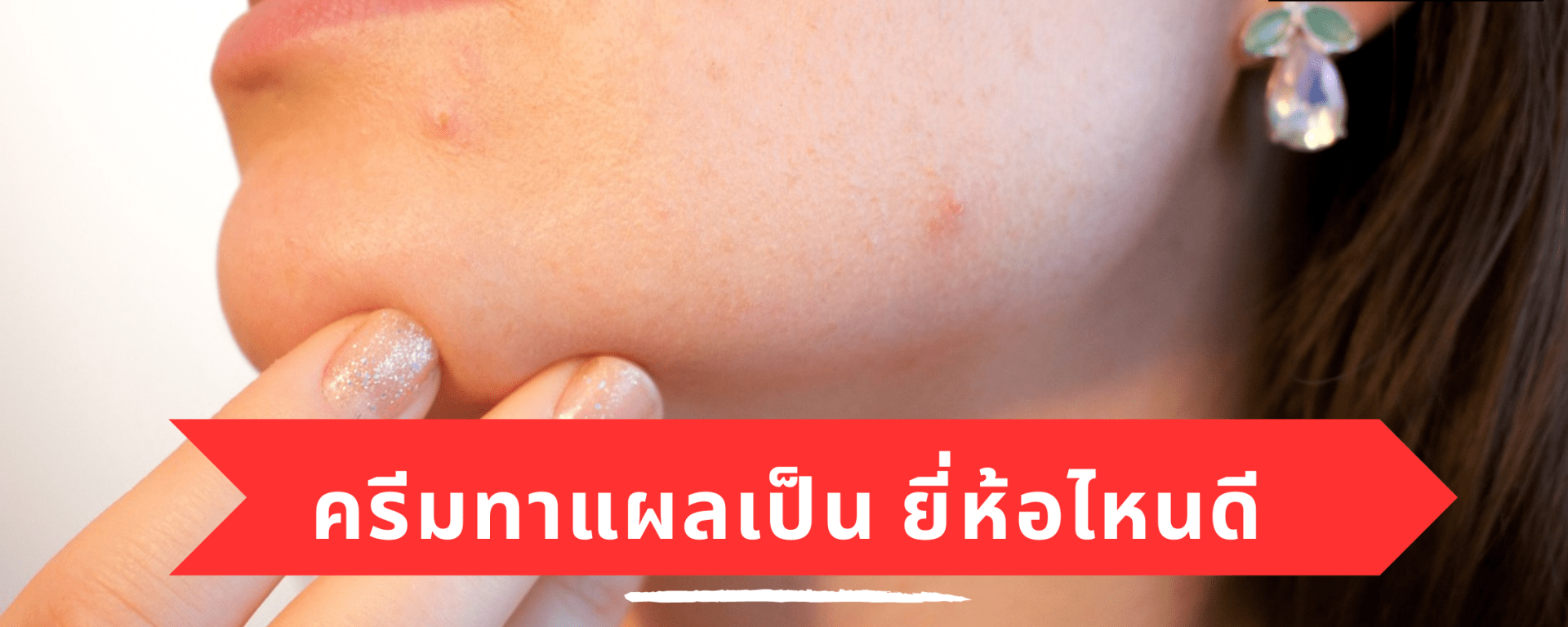 10 ยาทาแผลเป็น ครีมลดเลือนริ้วรอย ใบหน้า ผิวกาย แผลผ่าตัด หลังคลอด