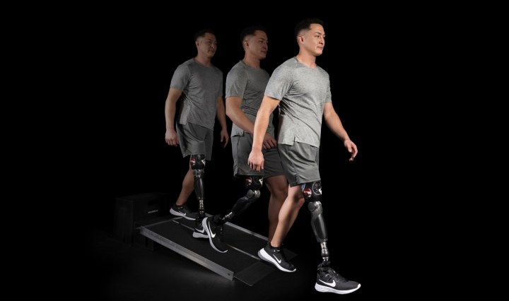 10 อันดับขาเทียมที่ดีที่สุด ราคาเท่าไหร่ หาซื้อได้จากที่ไหน (อัปเดต 2025)